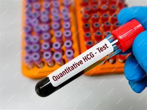 Beta hCG Test : Quantitative, accuracy, & pregnancy .